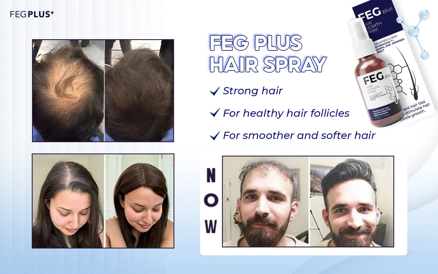 FEG Hair Growth Spray Serum for Hair Loss Prevention