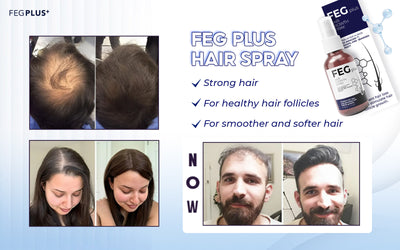 FEG Hair Growth Spray Serum for Hair Loss Prevention
